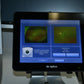 Optos Daytona plus Fundus Camera w/ Auto-Fluorescence - OptosAdvance Software