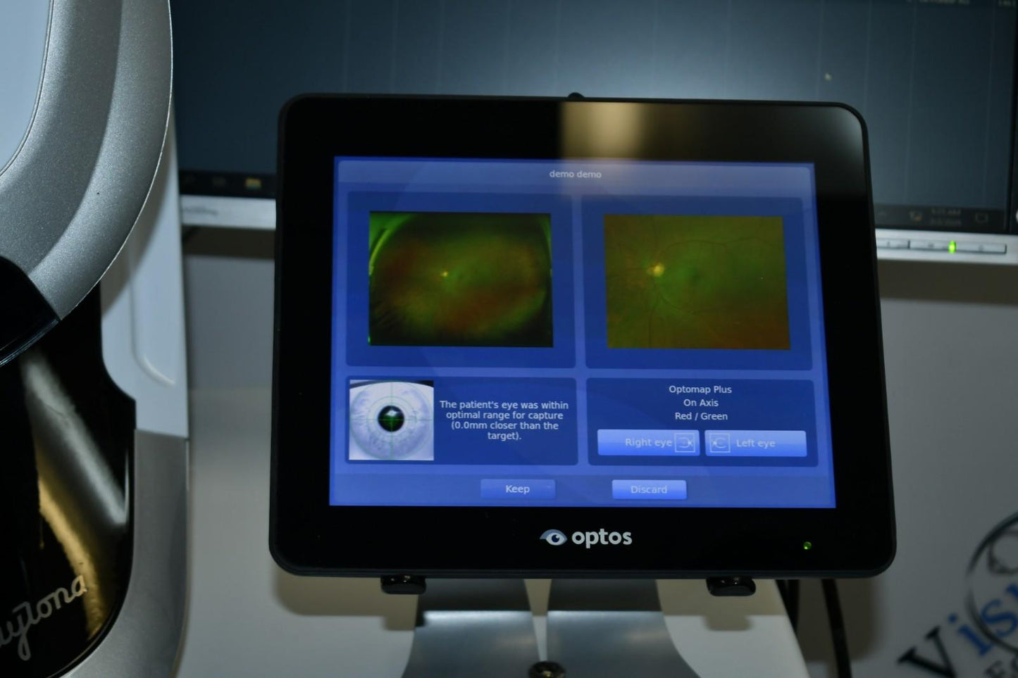 Optos Daytona plus Fundus Camera w/ Auto-Fluorescence - OptosAdvance Software