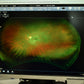 Optos Daytona plus Fundus Camera w/ Auto-Fluorescence - OptosAdvance Software