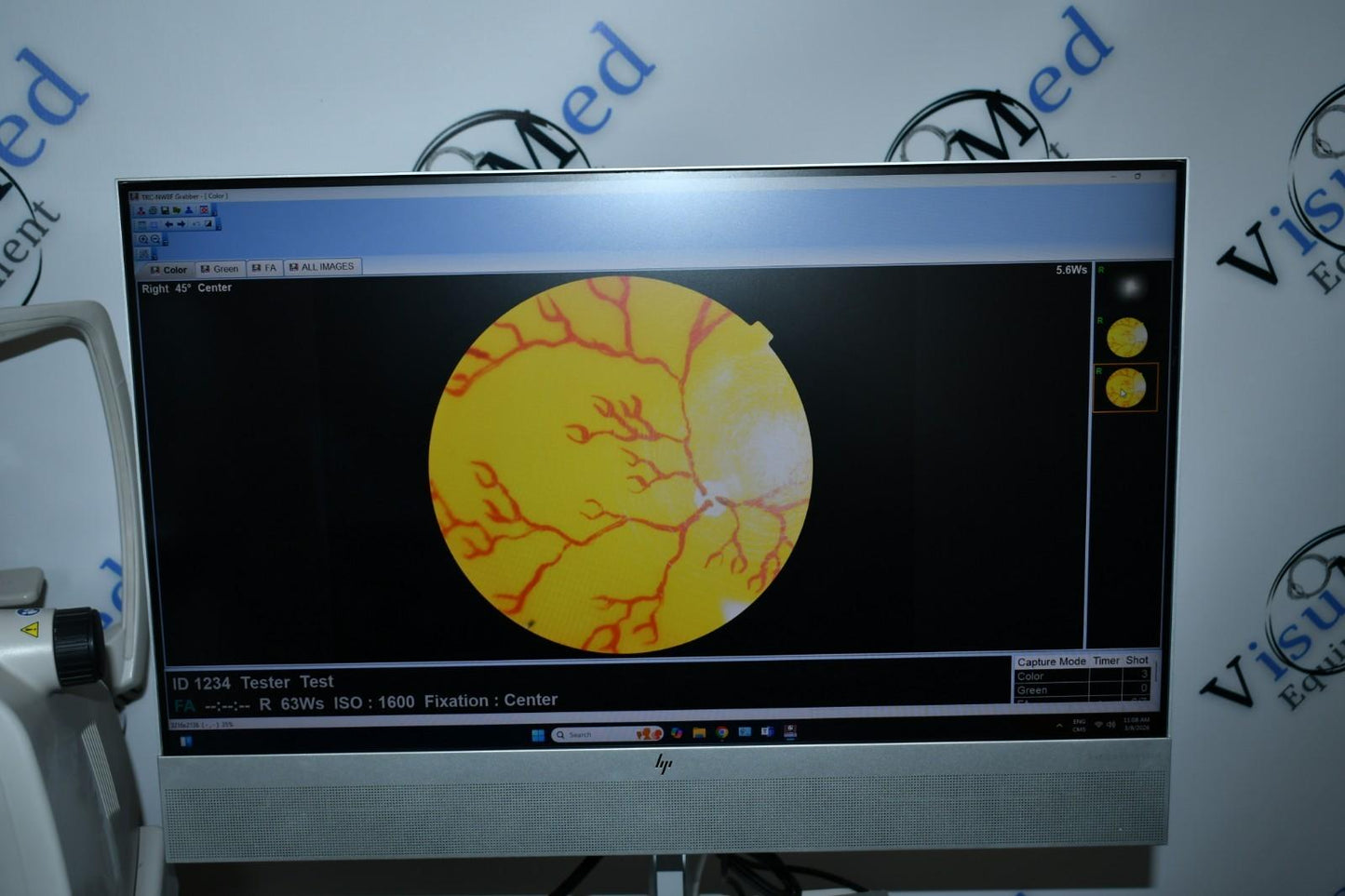 Topcon TRC-NW8F Win 11  Imagenet 6 Non-Myd Retinal Camera with Color/Red-Free/FA