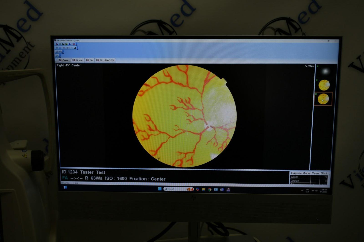 Topcon TRC-NW8F Win 11  Imagenet 6 Non-Myd Retinal Camera with Color/Red-Free/FA
