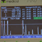 Refurbished QUANTEL MEDICAL AXIS II Ultrasound A-Scan  Biometer offered by Visumed Equipment
