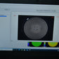 Lumenis ANTARES Corneal Topographer