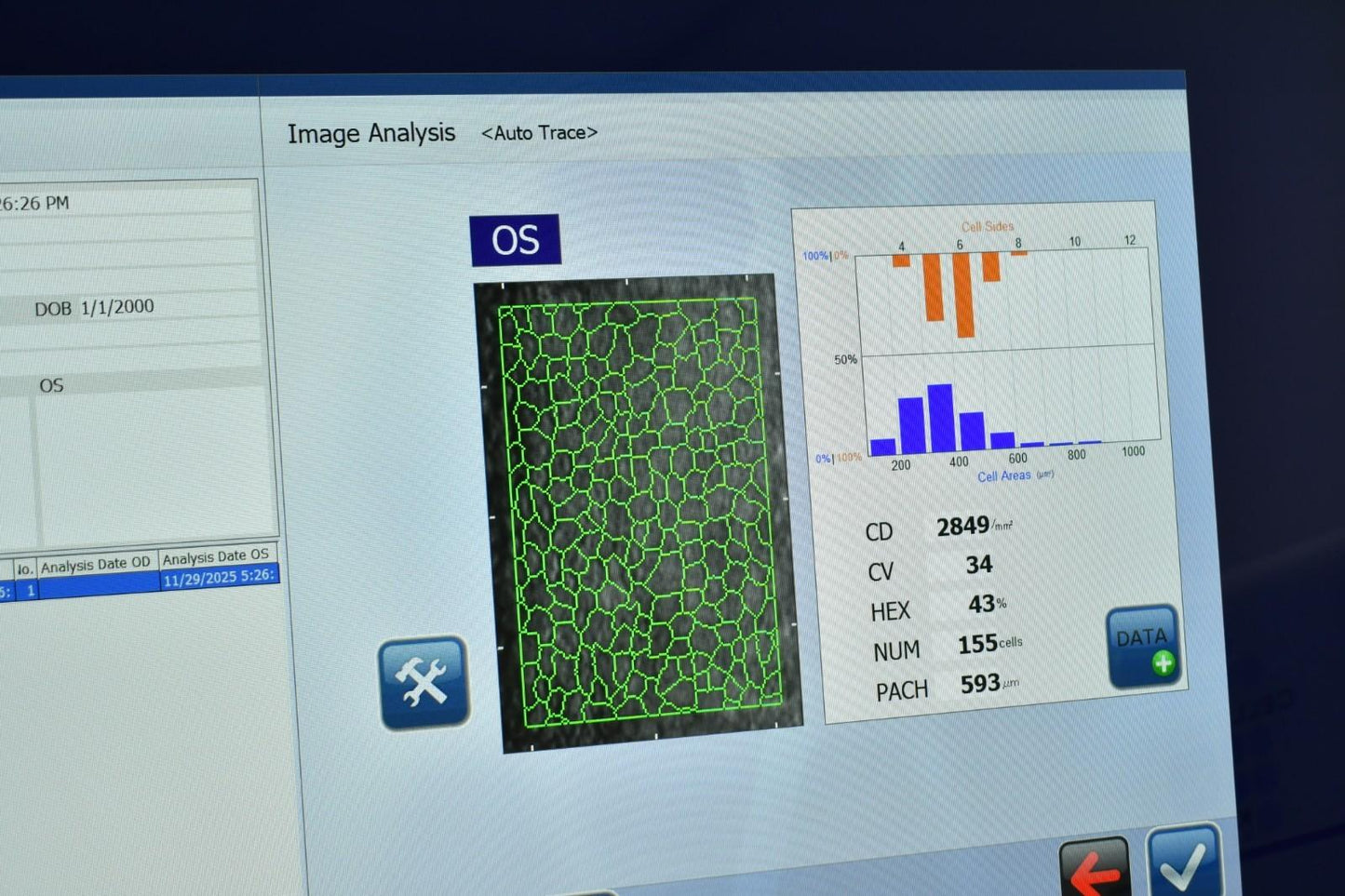 Konan Medical XL win 10 latest software Non-Contact Specular Scope