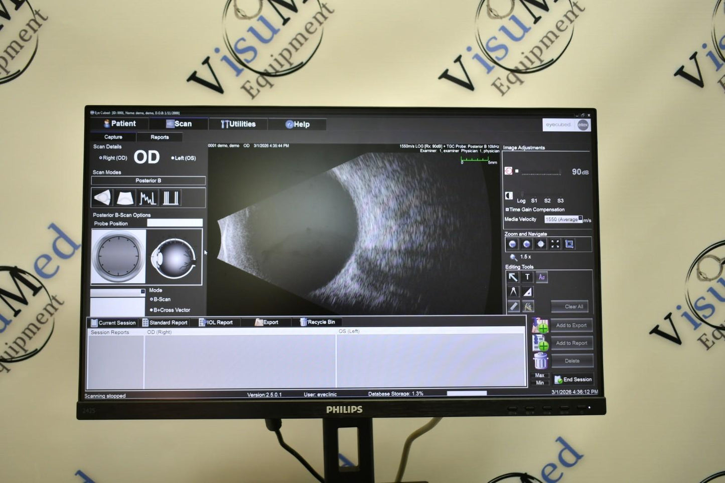 Ellex V4 Eye cubed B-scan UBM ophthalmic ultrasound