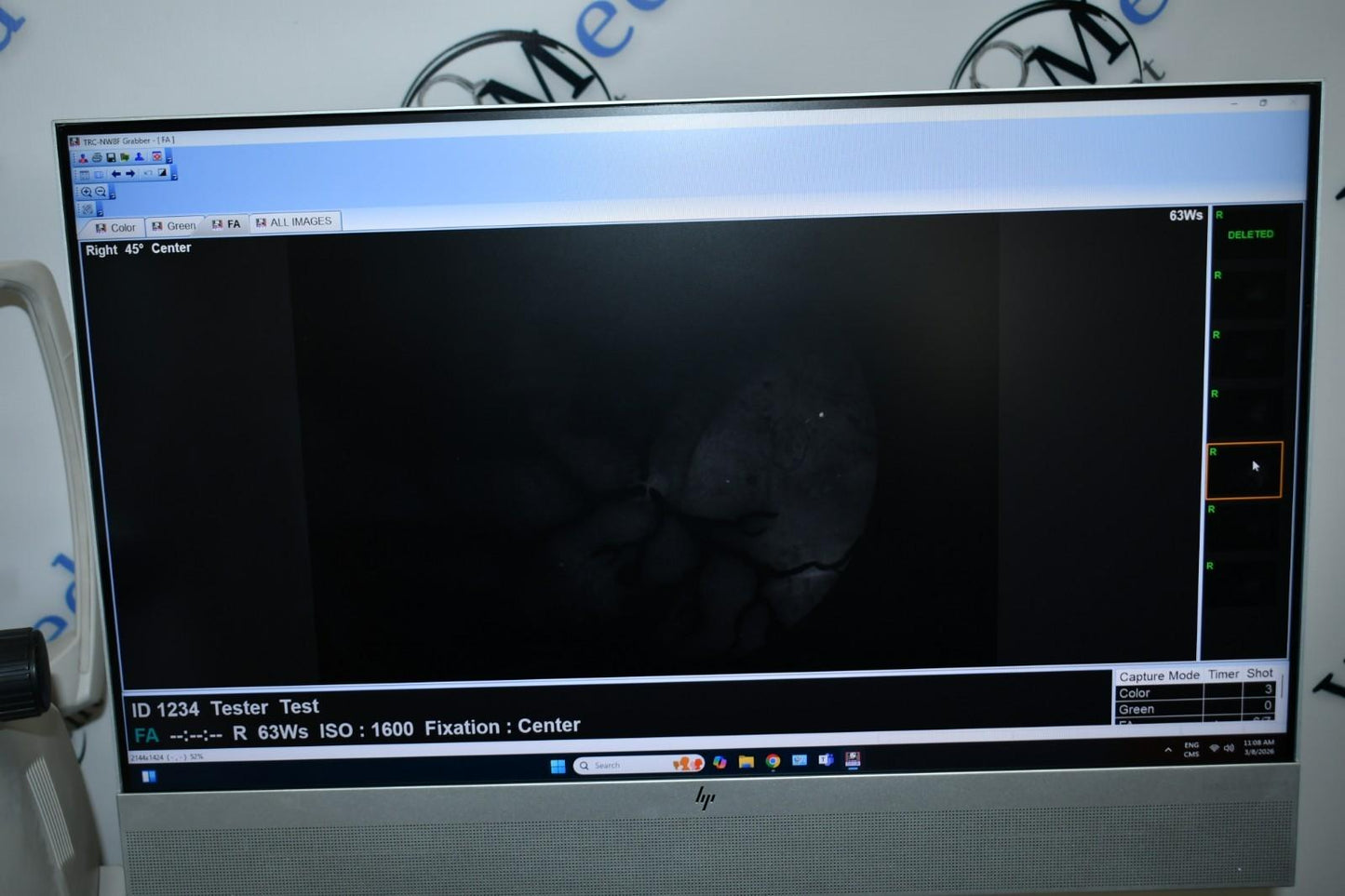 Topcon TRC-NW8F Win 11  Imagenet 6 Non-Myd Retinal Camera with Color/Red-Free/FA