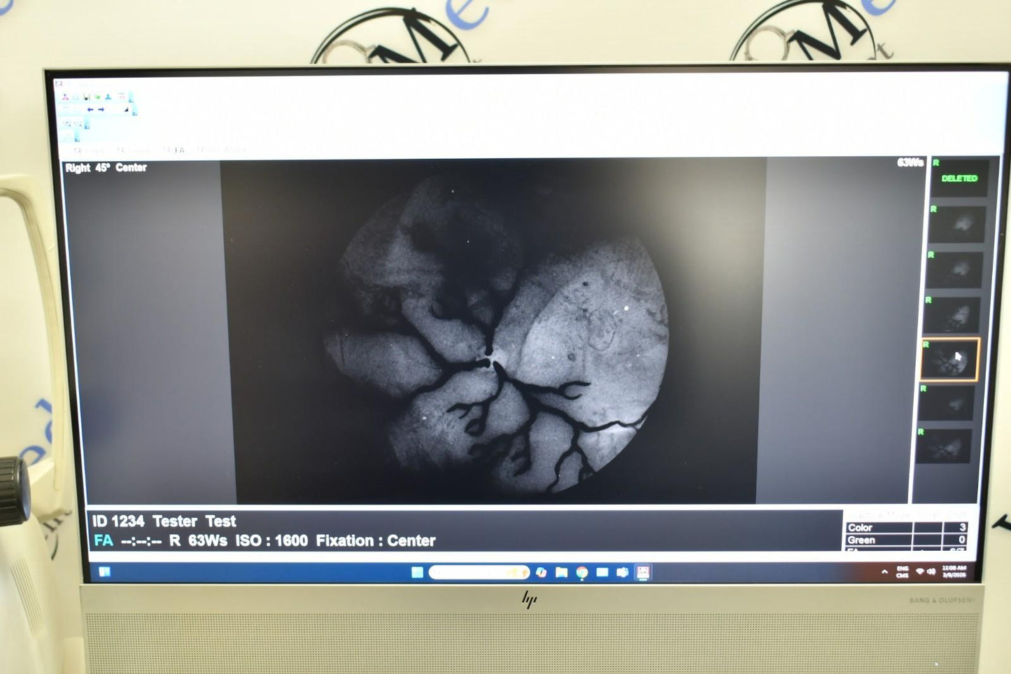 Topcon TRC-NW8F Win 11  Imagenet 6 Non-Myd Retinal Camera with Color/Red-Free/FA