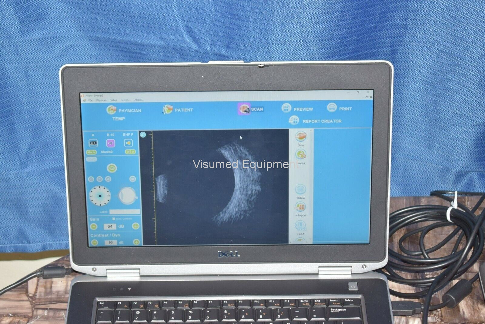 Quantel Medical Aviso A and B scan Ultrasound complete-Visumed Equipment