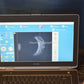 Quantel Medical Aviso A and B scan Ultrasound complete-Visumed Equipment