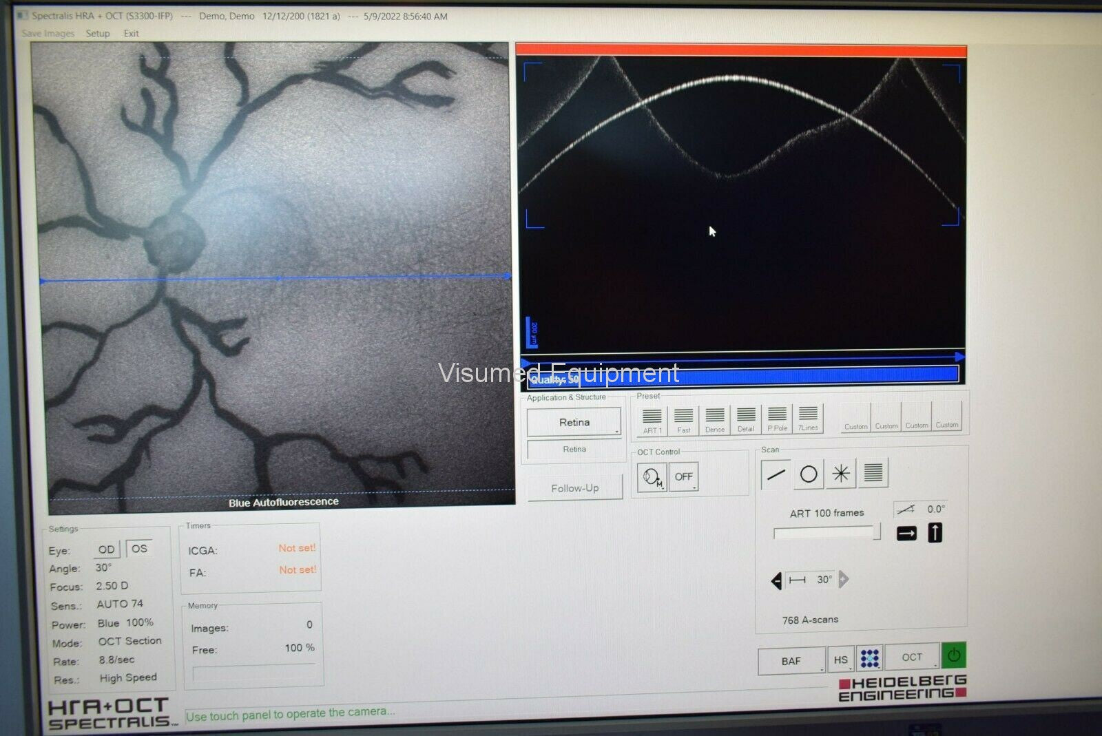 Heidelberg Spectralis OCT HRA 6 mode camera with IR Blue Peak, ICG and FFA-Visumed Equipment