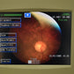 Refurbished Nidek Handy NM-200D non-mydriatic Fundus Camera offered by Visumed Equipment