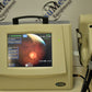 Refurbished Nidek Handy NM-200D non-mydriatic Fundus Camera offered by Visumed Equipment