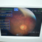 Refurbished Nidek Handy NM-200D non-mydriatic Fundus Camera offered by Visumed Equipment