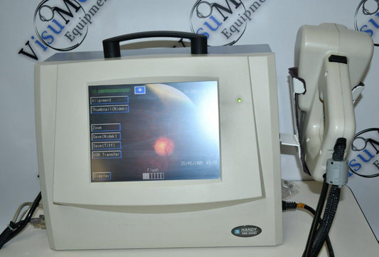 Nidek Handy NM-200D Non-mydriatic Fundus Camera