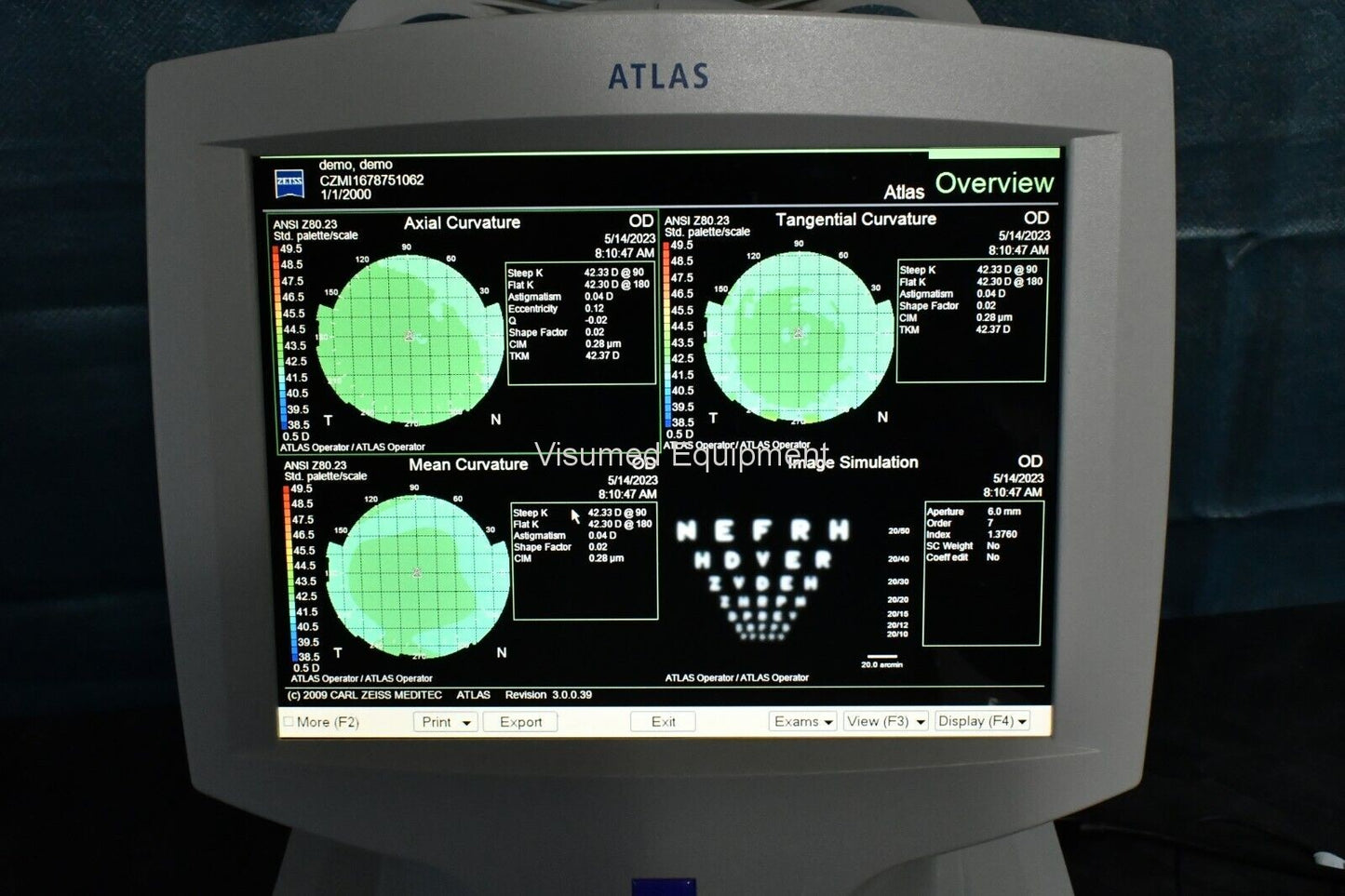 Zeiss Atlas 9000 Corneal Topographer - Visumed Equipment