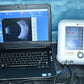 Quantel Medical Aviso A and B scan Ultrasound complete-Visumed Equipment