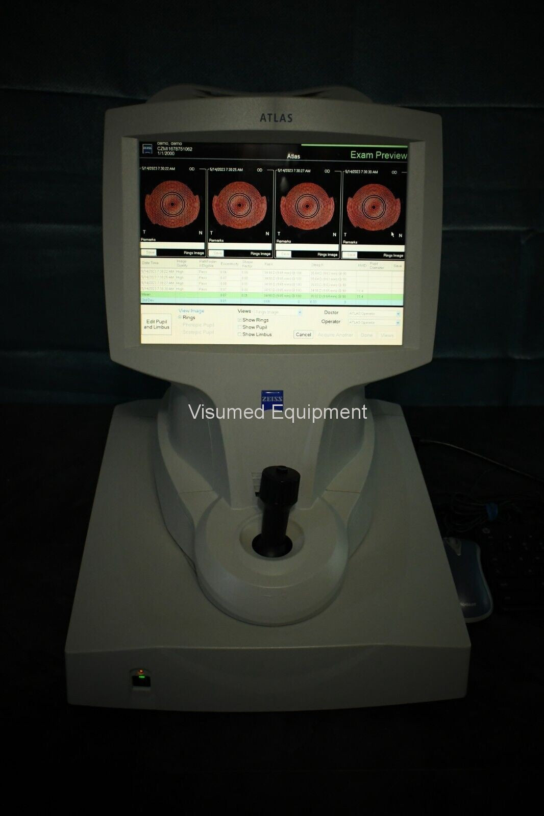 Zeiss Atlas 9000 Corneal Topographer - Visumed Equipment