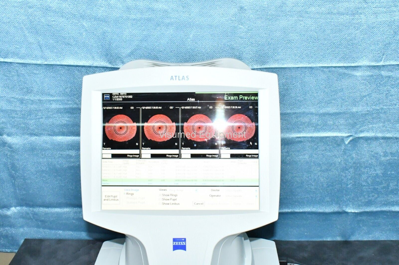 Zeiss Atlas 9000 Corneal Topographer - Visumed Equipment