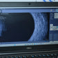 DGH Scanmate Flex B-scan - photo 2