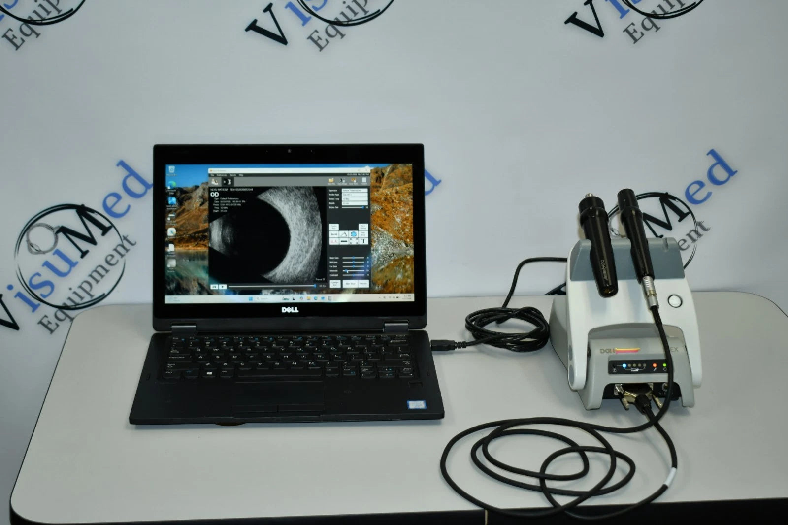 DGH Scanmate Flex B-scan UBM - photo 2