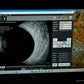 DGH Scanmate Flex B-scan UBM - photo 3