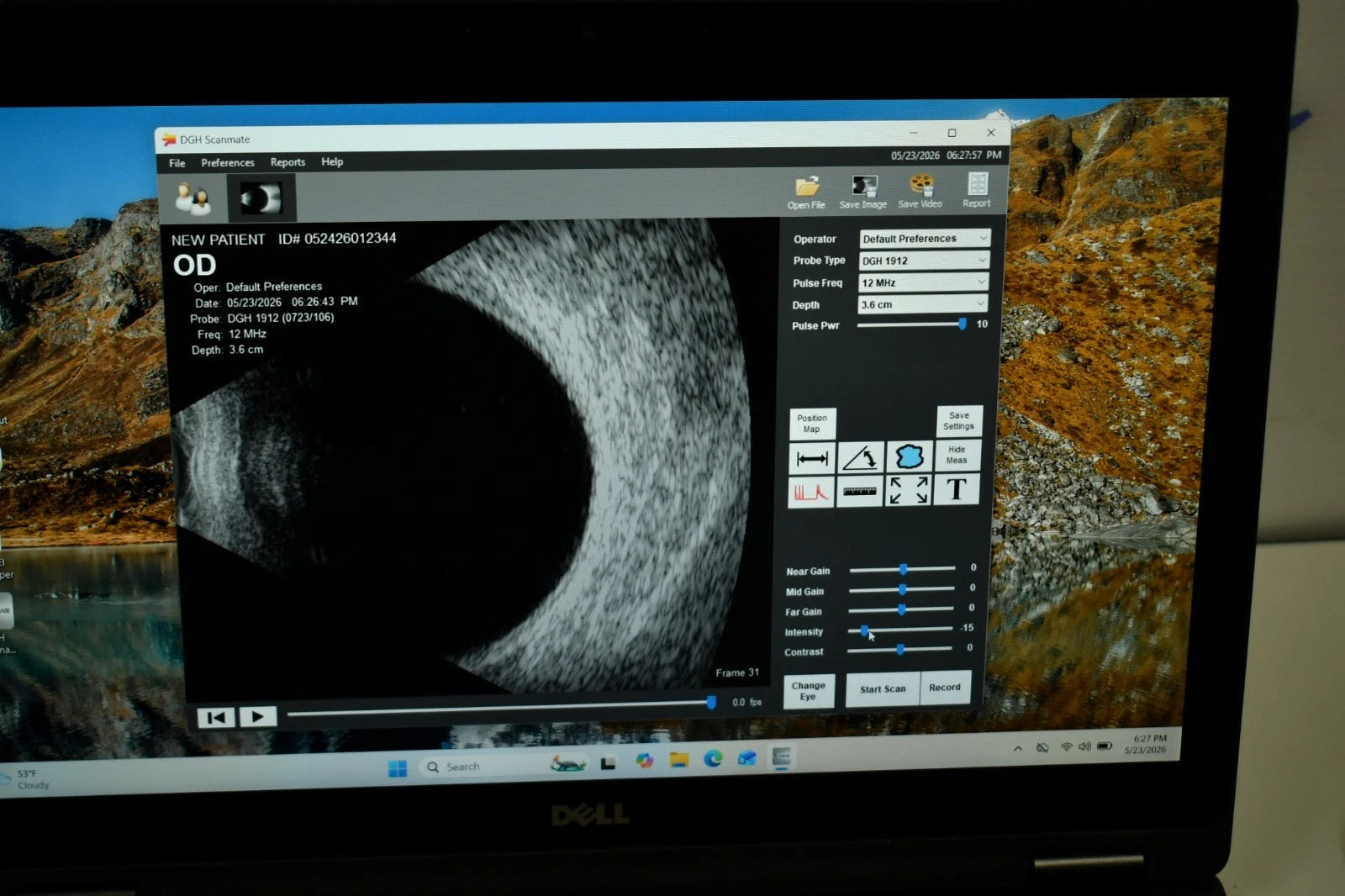 DGH Scanmate Flex B-scan UBM - photo 3