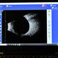 Quantel Aviso S A-Scan, B-Scan and UBM Ophthalmic Ultrasound
