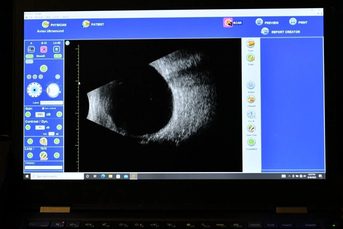 Quantel Aviso S A-Scan, B-Scan and UBM Ophthalmic Ultrasound