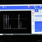 Quantel Aviso S A-Scan, B-Scan and UBM Ophthalmic Ultrasound
