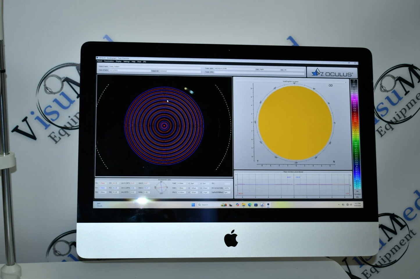 Oculus Keratograph 5M topographer photo 2