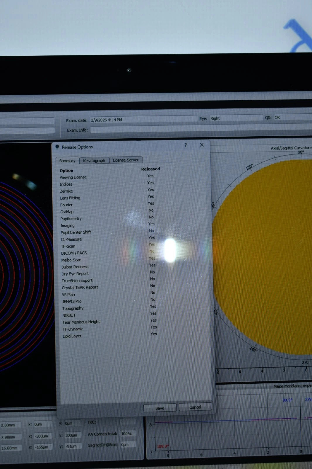 Oculus Keratograph 5M topographer photo 3