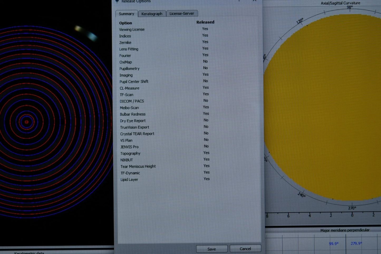 Oculus Keratograph 5M topographer photo 4