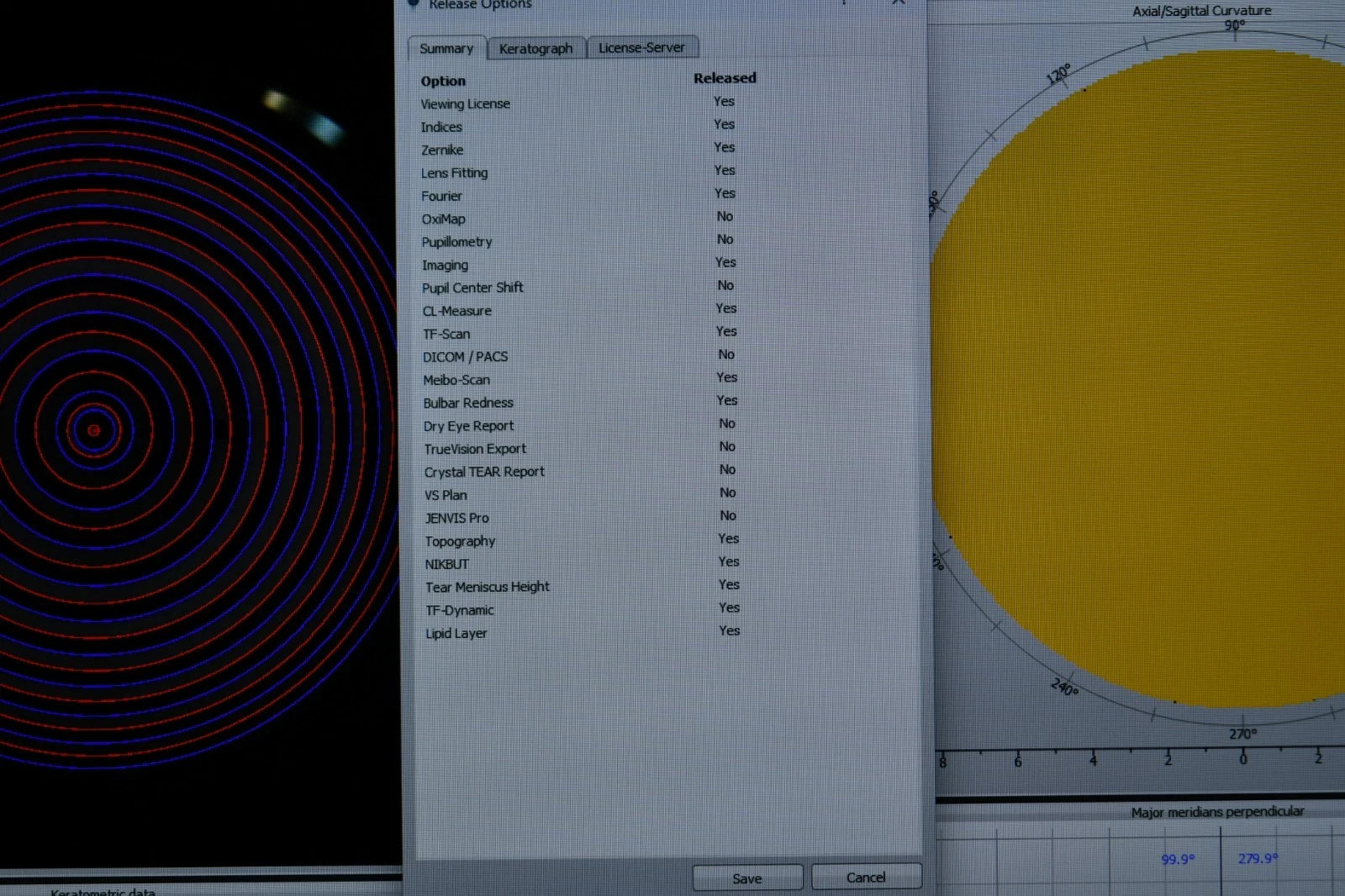 Oculus Keratograph 5M topographer photo 4
