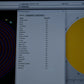 Oculus Keratograph 5M topographer photo 5