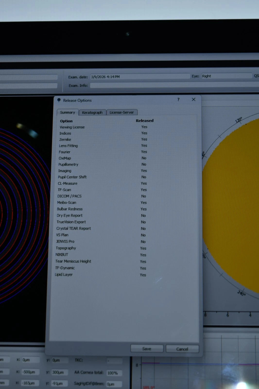 Oculus Keratograph 5M topographer photo 5