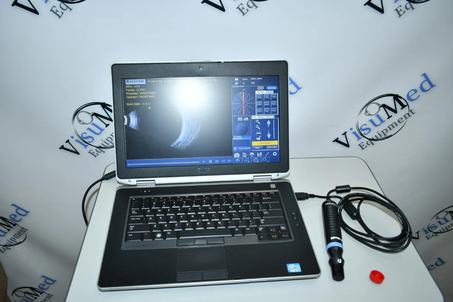 Accutome B-scan Plus ophthalmic ultrasound photo 1