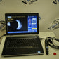 Accutome B-scan Plus ophthalmic ultrasound photo 3