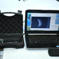 MMD PalmScan A2000 Ophthalmic B-scan photo 1