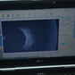MMD PalmScan A2000 Ophthalmic B-scan photo 2