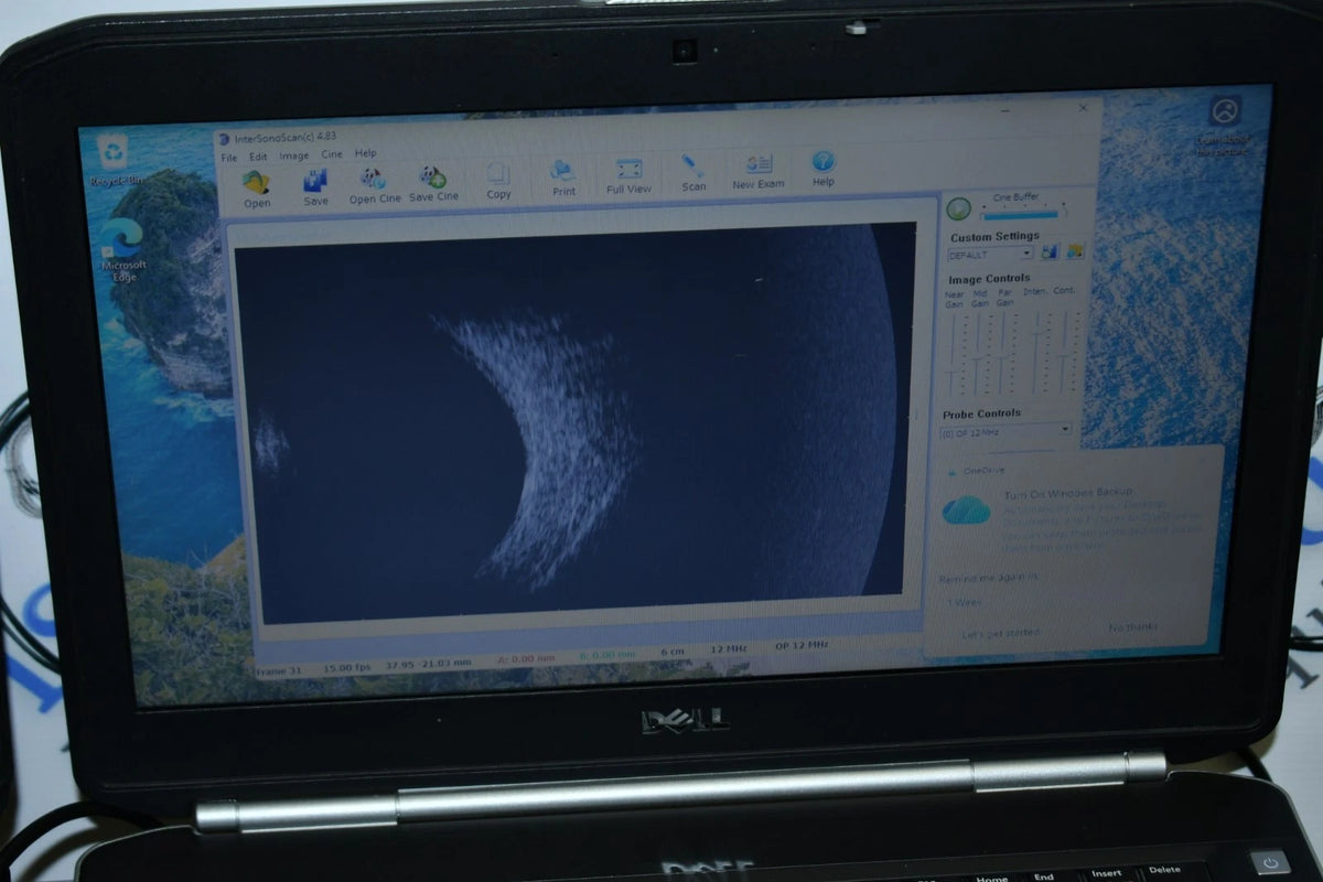 MMD PalmScan A2000 Ophthalmic B-scan photo 2