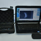 MMD PalmScan A2000 Ophthalmic B-scan photo 4