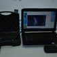 MMD PalmScan A2000 Ophthalmic B-scan photo 5
