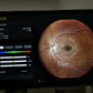 iCare EIDON TrueColor - photo 4