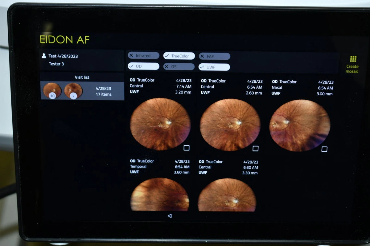 iCare Centervue EIDON fundus camera - photo 5