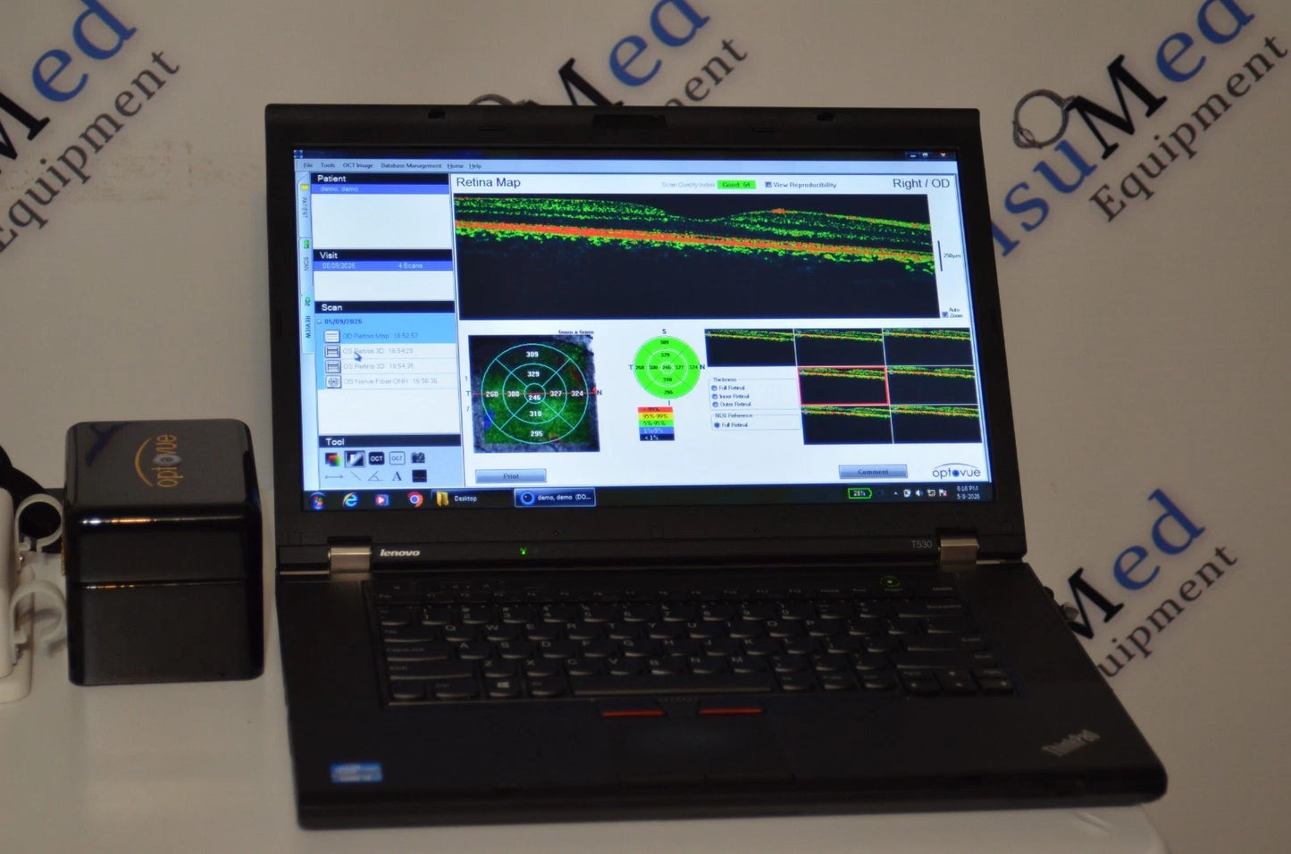 Optovue iVue Gen 2 OCT - photo 3