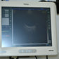 Reichert Reflex B-scan photo 2