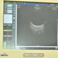 Reichert Reflex B-scan photo 3