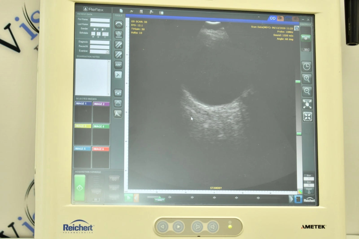 Reichert Reflex B-scan photo 3