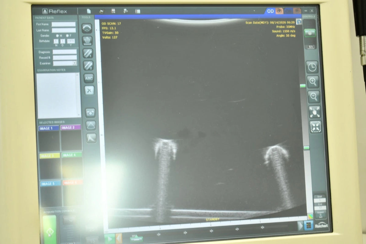 Reichert Reflex B-scan photo 5