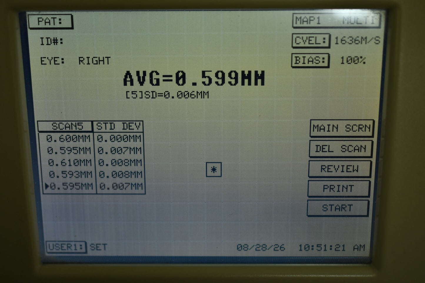 Sonomed PacScan 300AP probe